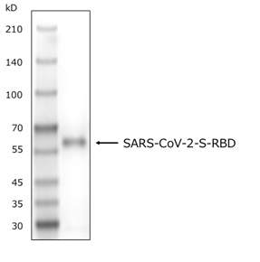 PAGE_SARS-CoV-2 PAGE_SARS-CoV-2
